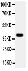 1 - Anti-MADCAM-1 Antibody ABO11390
