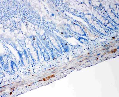 2 - Anti-PC1/3 Antibody ABO11391