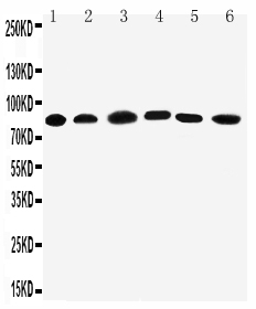 1 - Anti-PC1/3 Antibody ABO11391
