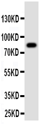 1 - Anti-ProProtein Convertase PC4 Antibody ABO11393