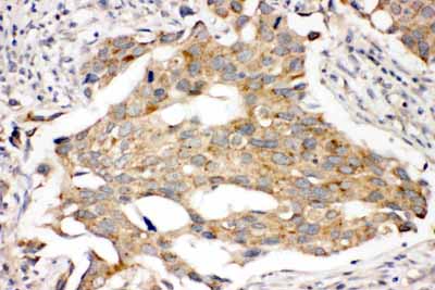 2 - Anti-PRLR Antibody ABO11394