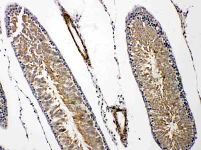 2 - Anti-PRLR Antibody ABO11394