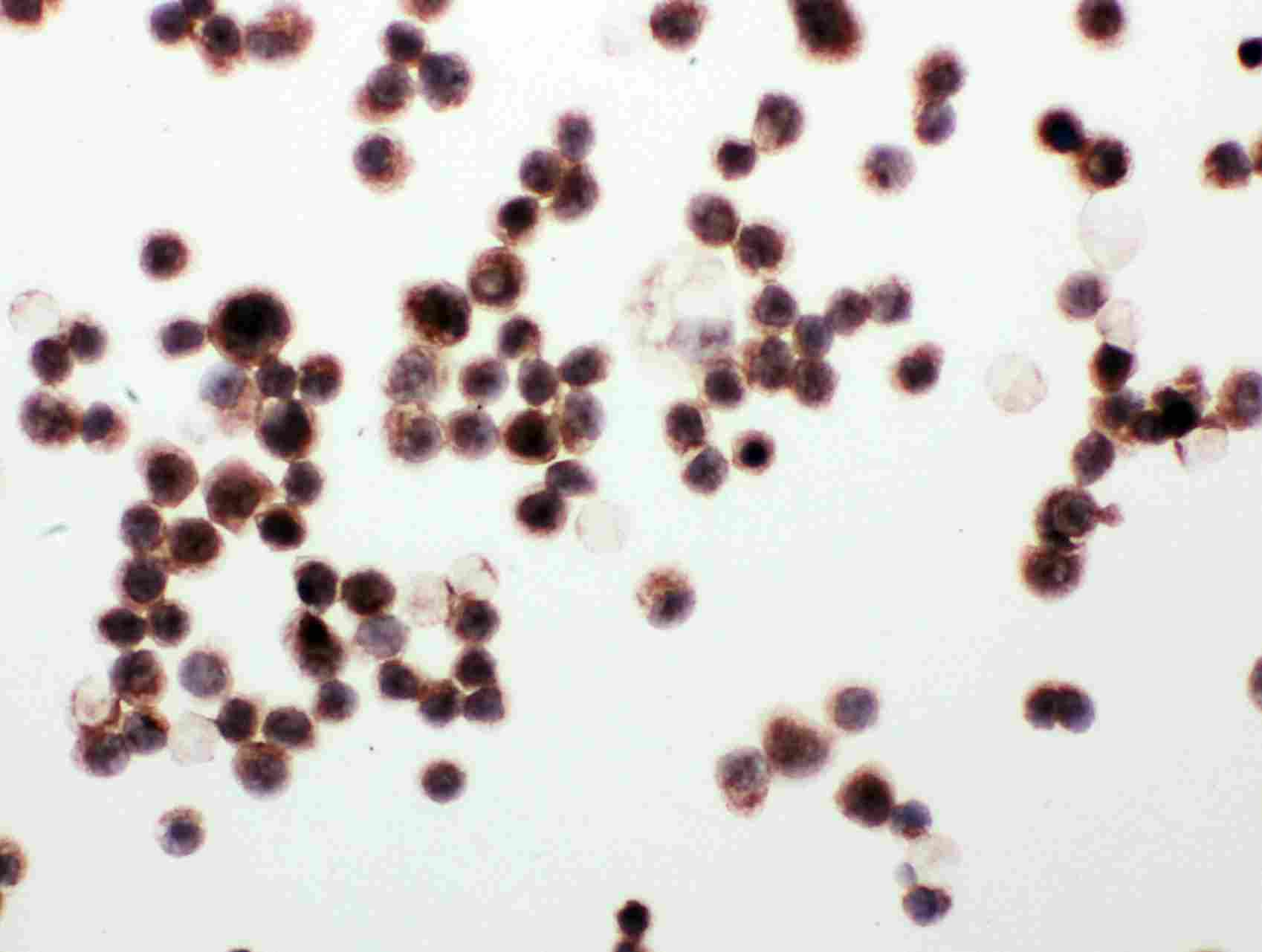 8 - Anti-WISP1/CCN4 Antibody ABO11396