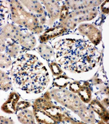 2 - Anti-WISP1/CCN4 Antibody ABO11396