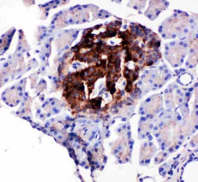 2 - Anti-WISP1/CCN4 Antibody ABO11396