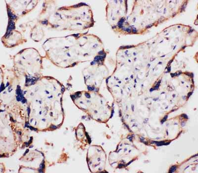 2 - Anti-WISP1/CCN4 Antibody ABO11396