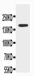 1 - Anti-ABCB4 Antibody ABO11397