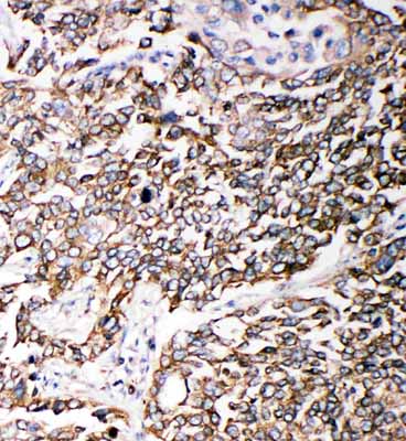 2 - Anti-PMP70 Antibody ABO11398