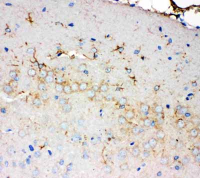 2 - Anti-PMP70 Antibody ABO11398