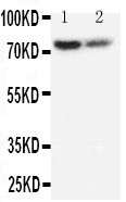 1 - Anti-PMP70 Antibody ABO11398