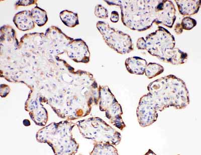 2 - Anti-Aquaporin 6 Antibody ABO11399