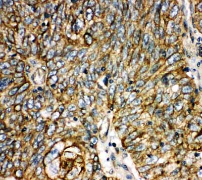 2 - Anti-Aquaporin 6 Antibody ABO11399