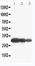 1 - Anti-Aquaporin 6 Antibody ABO11399
