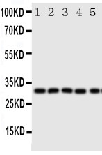 1 - Anti-Aquaporin 9 Antibody ABO11401