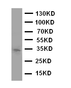 1 - Anti-Aquaporin 10 Antibody ABO11402