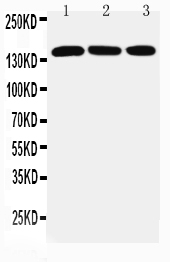 1 - Anti-ATX2 Antibody ABO11404