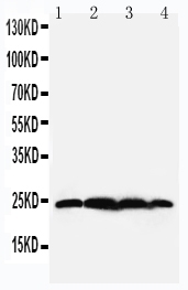 1 - Anti-BAG2 Antibody ABO11405