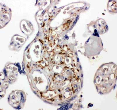 2 - Anti-BAG5 Antibody ABO11407