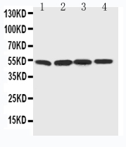 1 - Anti-BAG5 Antibody ABO11407