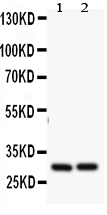 1 - Anti-Bcl2A1 Antibody ABO11408
