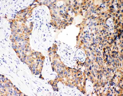 2 - Anti-Caspase-12 Antibody ABO11409