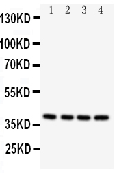 1 - Anti-Caspase-12 Antibody ABO11409