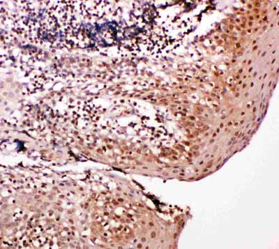2 - Anti-Caspase-14 Antibody ABO11410