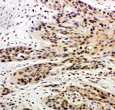 2 - Anti-Caspase-14 Antibody ABO11410