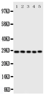 1 - Anti-Caspase-14 Antibody ABO11410