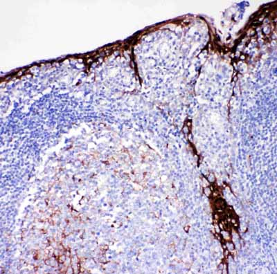 2 - Anti-Cystatin A Antibody ABO11411
