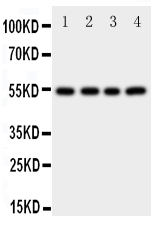 1 - Anti-Cystatin A Antibody ABO11411