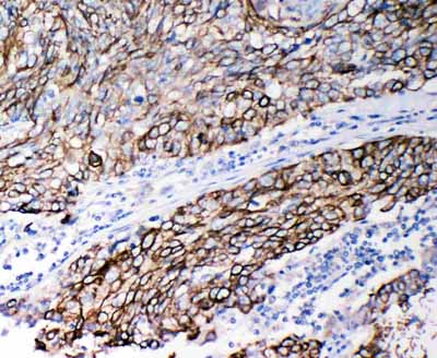 2 - Anti-Cystatin B Antibody ABO11412