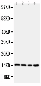 1 - Anti-Cystatin B Antibody ABO11412
