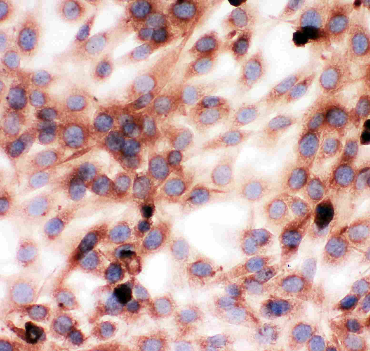 8 - Anti-Gelsolin Antibody ABO11415