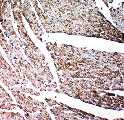 2 - Anti-Gelsolin Antibody ABO11415