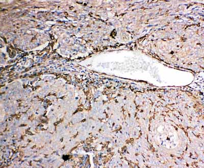 2 - Anti-Gelsolin Antibody ABO11415