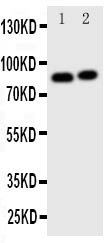 1 - Anti-Gelsolin Antibody ABO11415