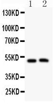 1 - Anti-Aquaporin 0 Antibody ABO11416
