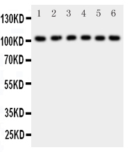 1 - Anti-NFkB p105/p50 Antibody ABO11417