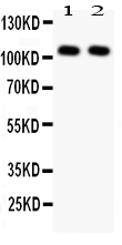 1 - Anti-NFkB p105/p50 Antibody ABO11418