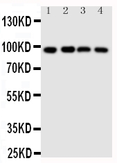 1 - Anti-SIDT1 Antibody ABO11420