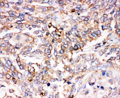 2 - Anti-Smad1 Antibody ABO11421