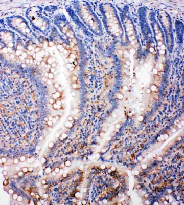 2 - Anti-SMAD5 Antibody ABO11422