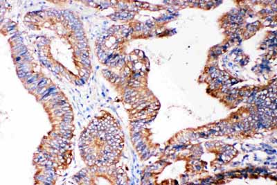 2 - Anti-SMAD5 Antibody ABO11422