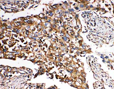 2 - Anti-SMAD5 Antibody ABO11422
