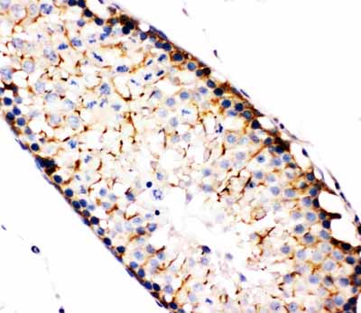 2 - Anti-NAK Antibody ABO11424