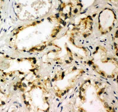 2 - Anti-NAK Antibody ABO11424