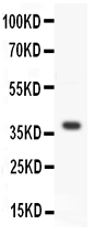 1 - Anti-Wnt3a Antibody ABO11426