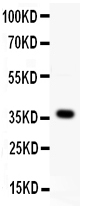 1 - Anti-Wnt4 Antibody ABO11427