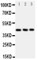 1 - Anti-CCR9 Antibody ABO11428